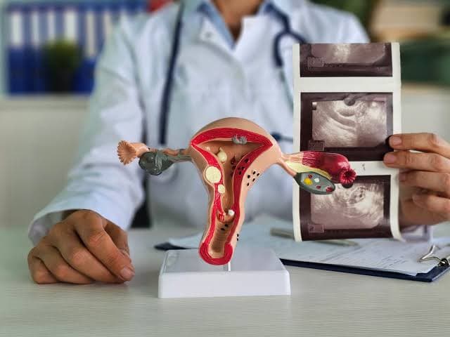 Understanding fibroids: What every woman should know this Fibroid Awareness Month