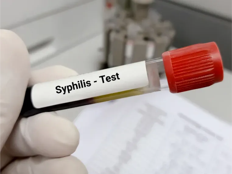Barbados reports sharp rise in syphilis cases, urges increased testing and safer sex practices