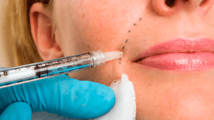 dermal fillers